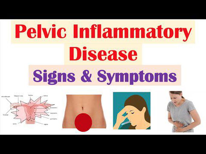 Pelvic Inflammatory disease