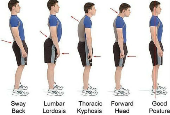 Body postures