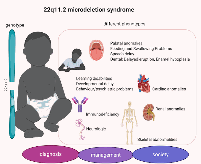 Microdeletion syndrome