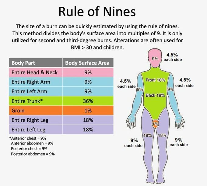 Rule Of Nines Medizzy 