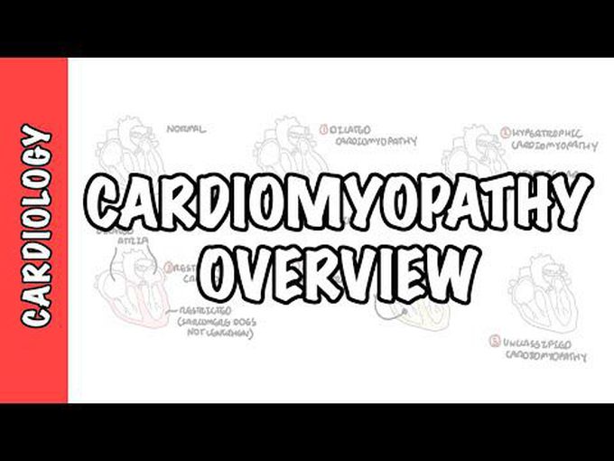 Types of Cardiomyopathy.
