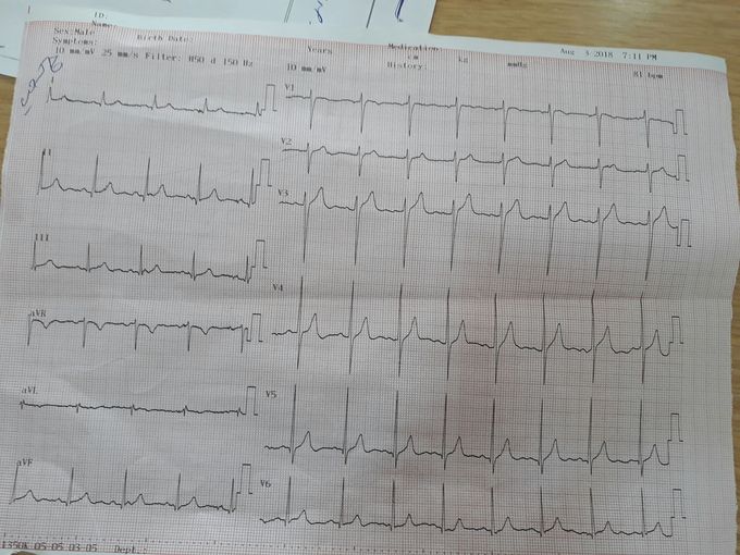 What is your diagnosis