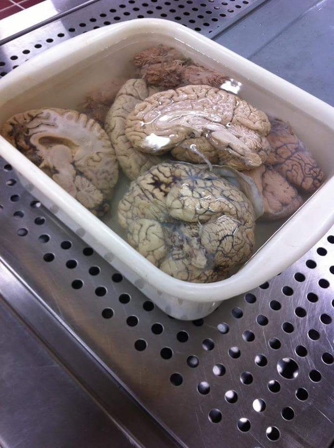 Neuro