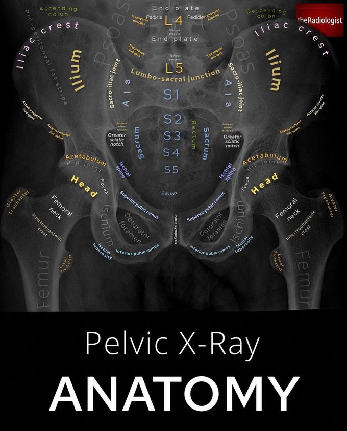 Pelvic X-ray Anatomy