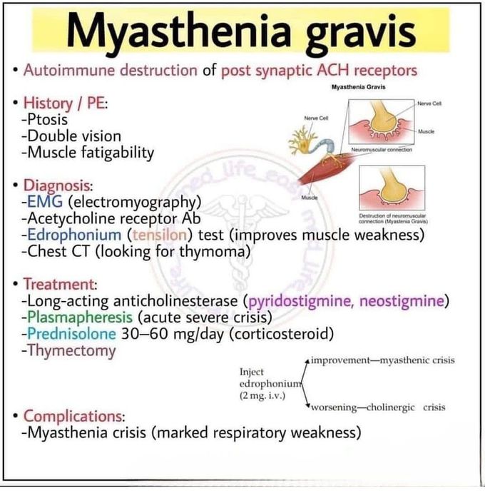 Myasthenia Gravis