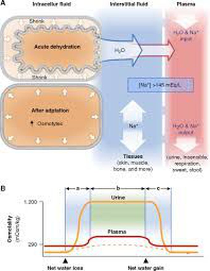 Causes of hypernatremia