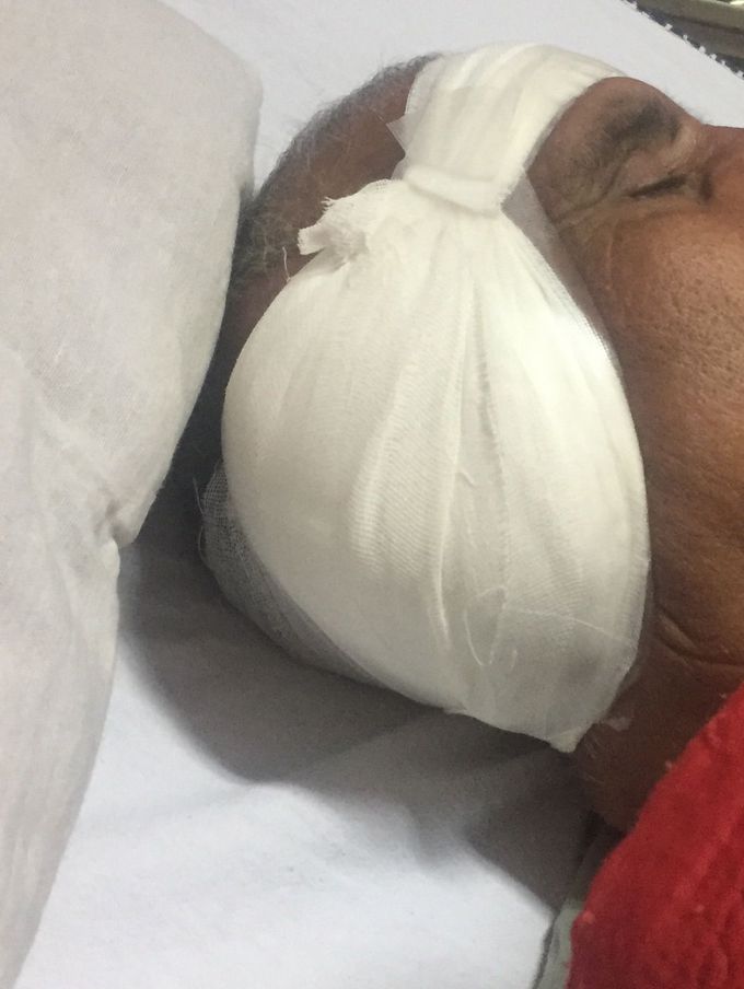 Patient with cyst in middle ear