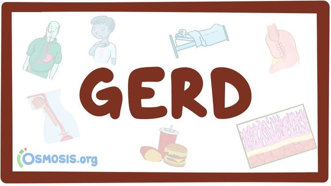 Gastro-esophageal reflux disease (GERD) - causes, symptoms, diagnosis, treatment, pathology