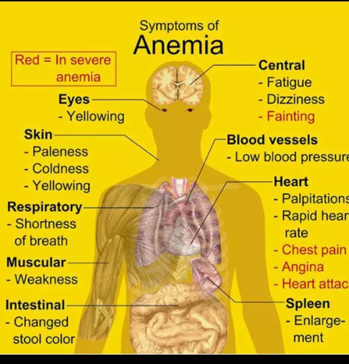 Symptoms #anemia#best#