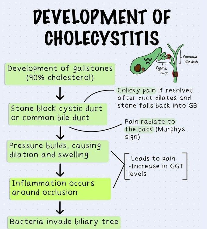 Development of Cholecystitis