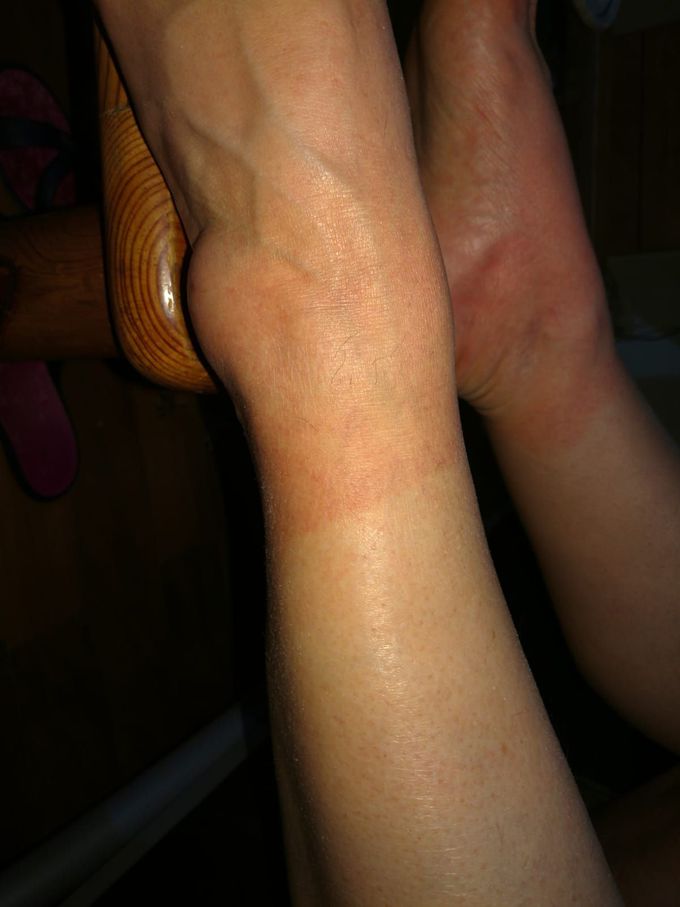 Diagnosis?