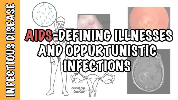AIDS-defining illnesses