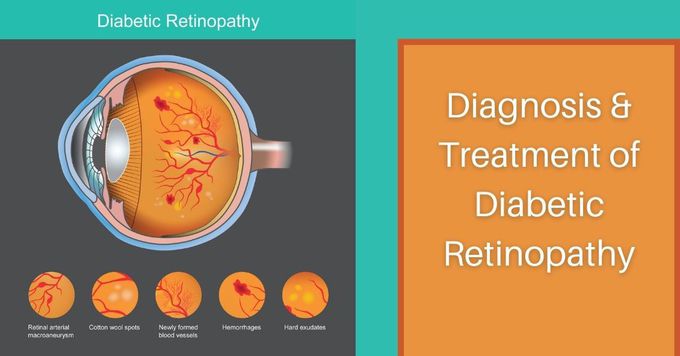 Treatment for Diabetic Retinopathy