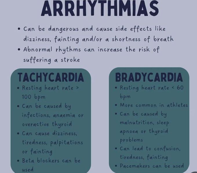 Arrhythmias