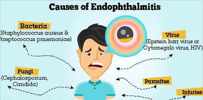 Cause of Endophthalmitis