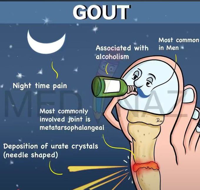 Gout-Mnemonic