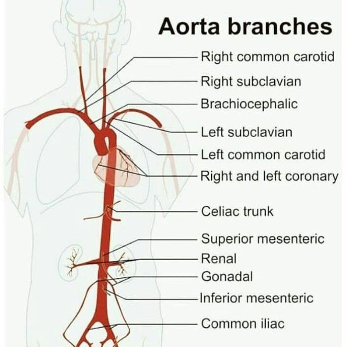 "Arota branches "