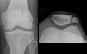 Multipatite patella - MEDizzy