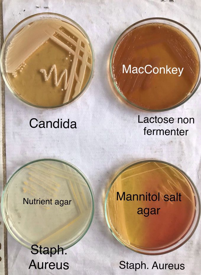 Different bacteria on different agar