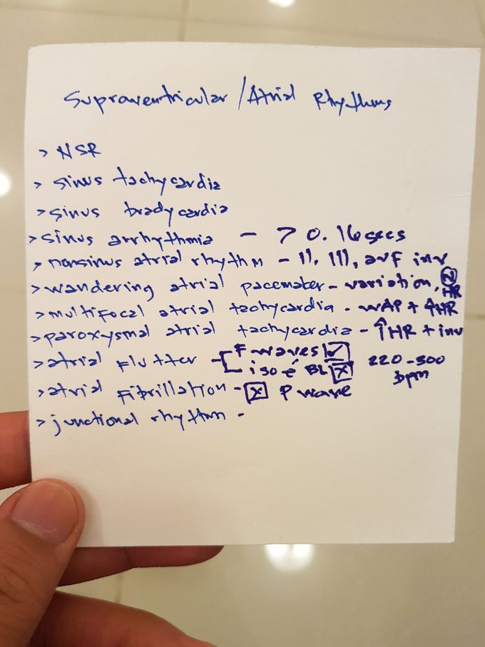 Supraventricular rhythms