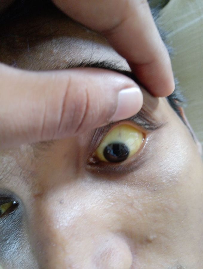 Diagnosis??