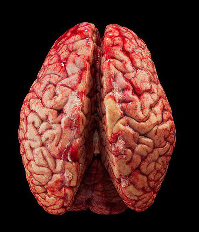 Human brain anatomy