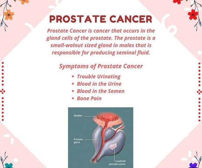 Prostate cancer