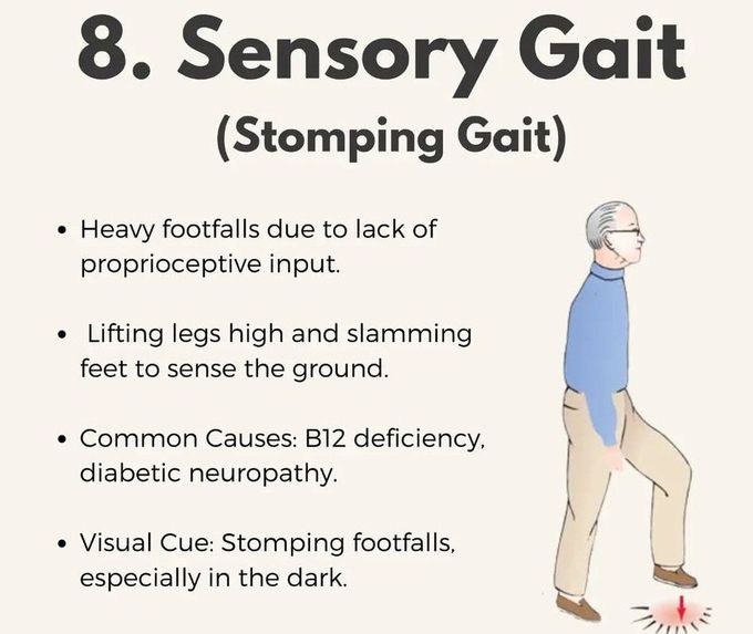 Sensory Gait