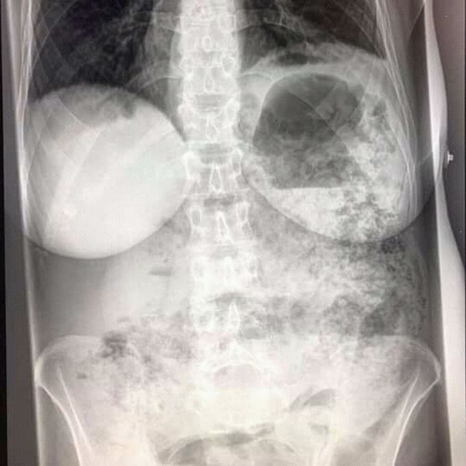 50yrs .abdomen pain plz explain cause