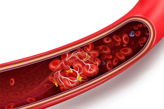 How are blood clots formed?