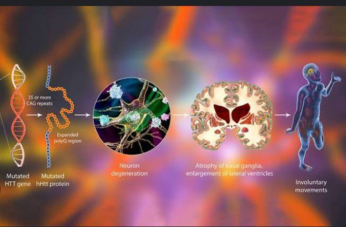 Cause Of Huntingtons Disease Medizzy 0731