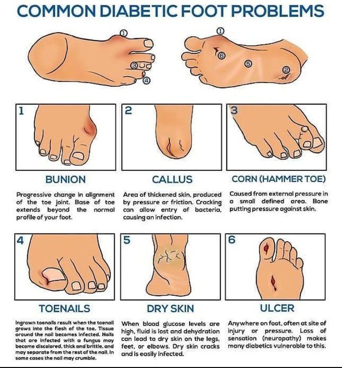 Diabetic food problems