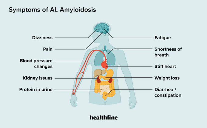 Risk Factors Of Amyloidosis Medizzy 6639