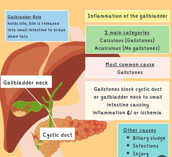 Cholecystitis I