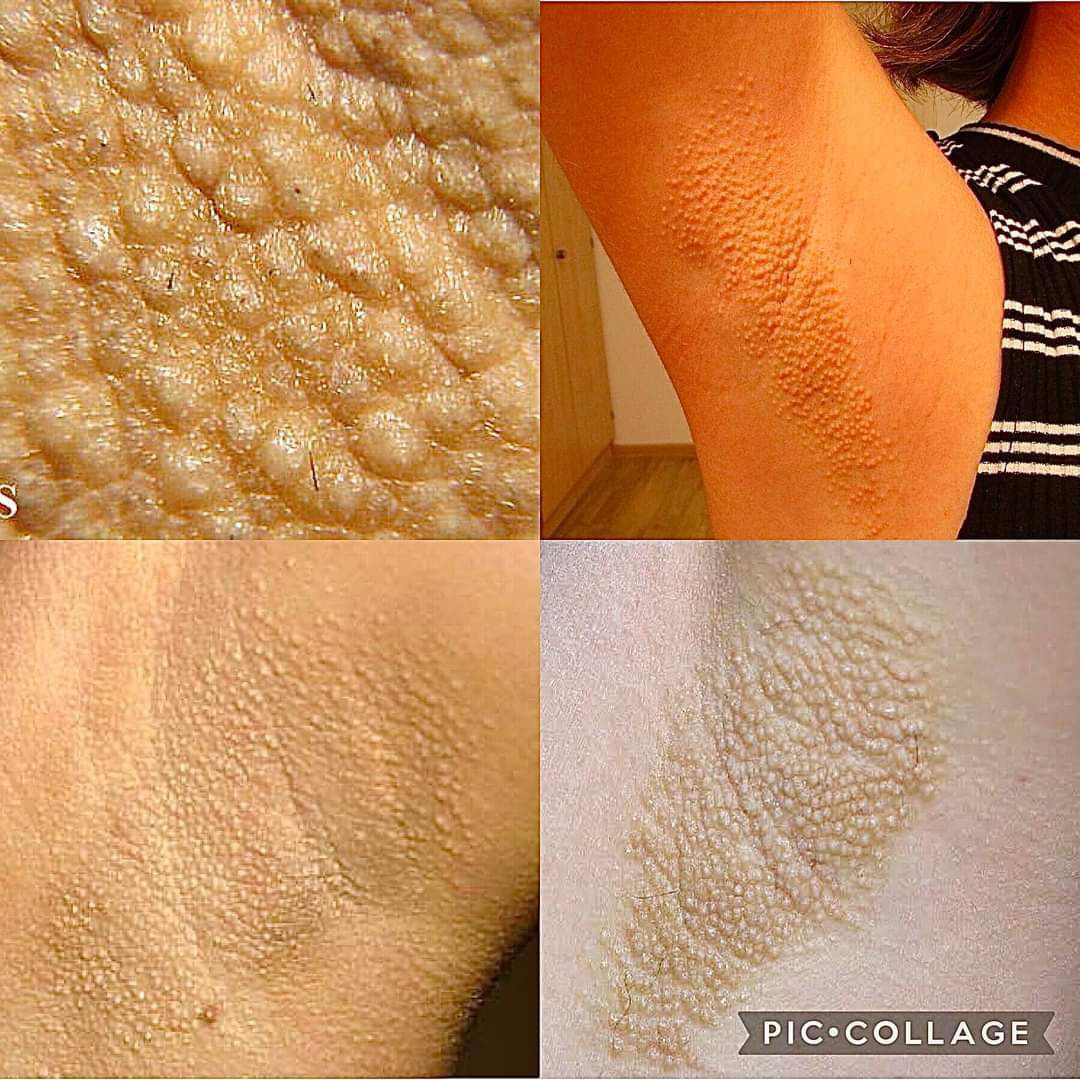 Dermatology - MEDizzy