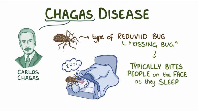 Chagas Disease