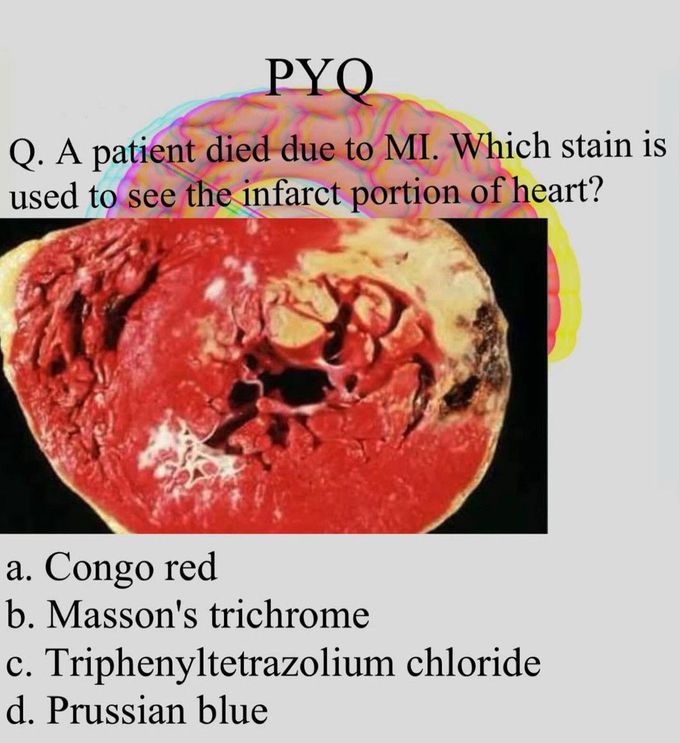 Identify the Stain