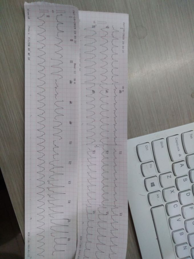 ECG case