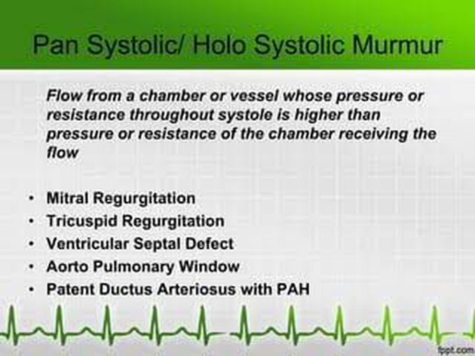 Pan Systolic Murmur