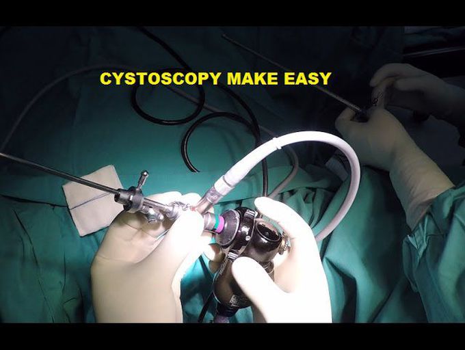 CYSTOSCOPY