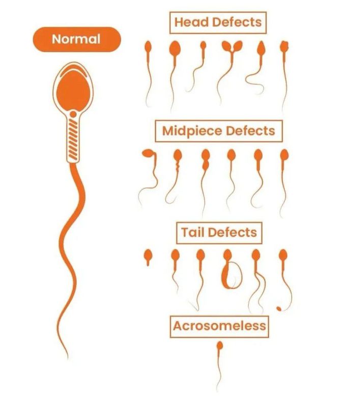 Normal Vs Defected Sperms