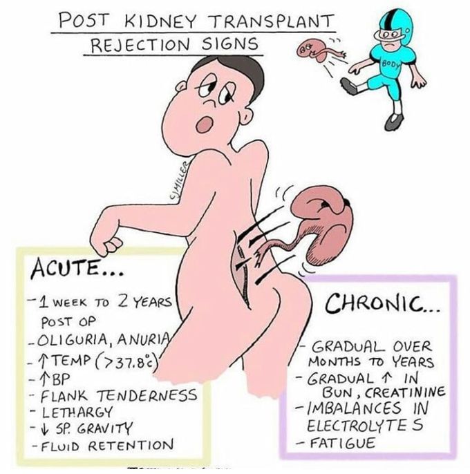 Transplant Rejection signs