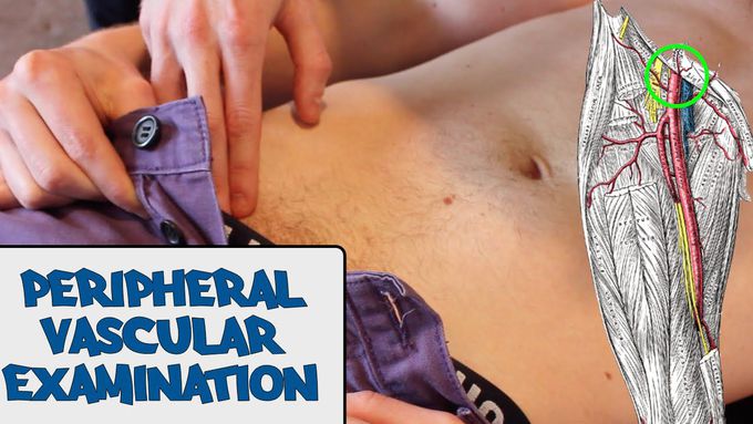Peripheral Vascular Examination