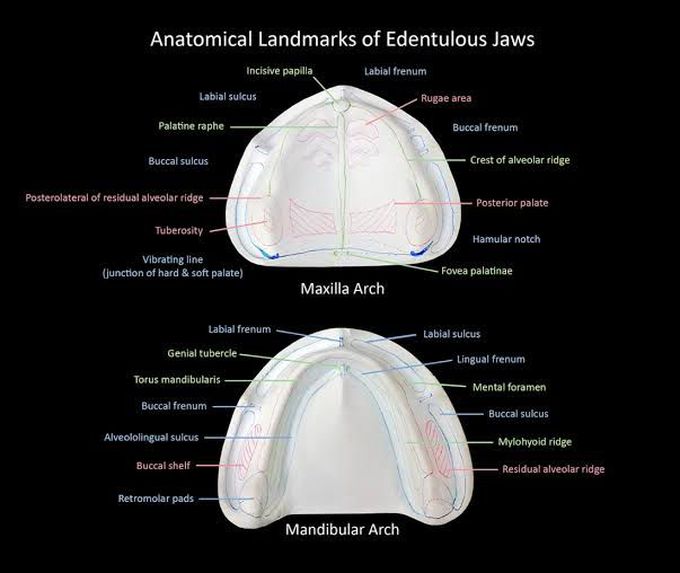 Anatomical Landmarks of Edentulous Arches
