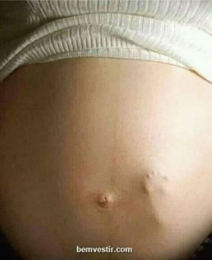 PREGNANCY  ist sign ?????