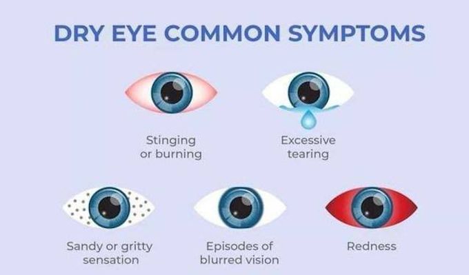These are the symptoms of dry eye syndrome
