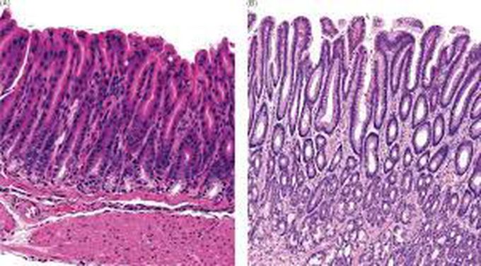 Foveolar cells