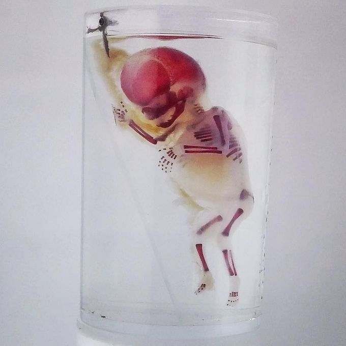 A preserved dyed human fetus. 
