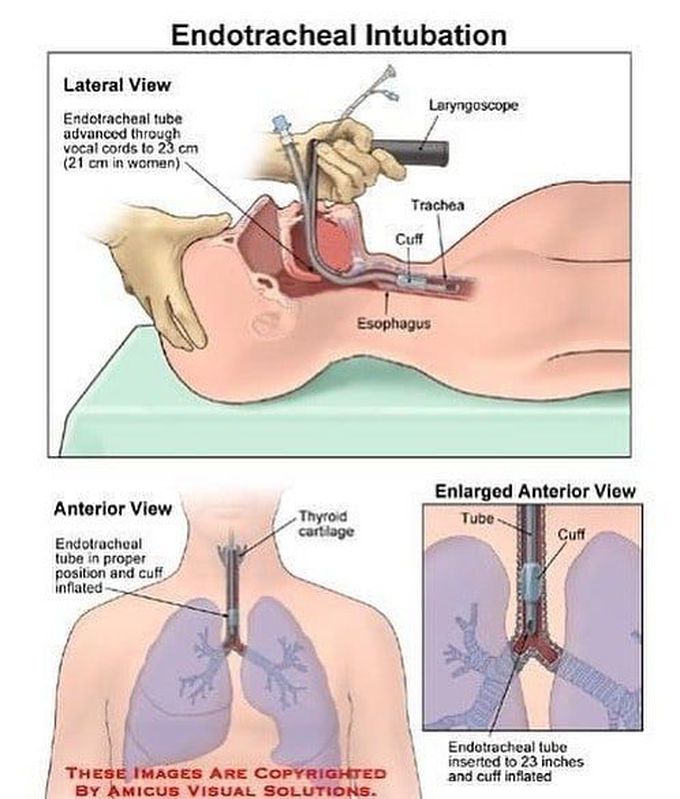 intubation anatomy