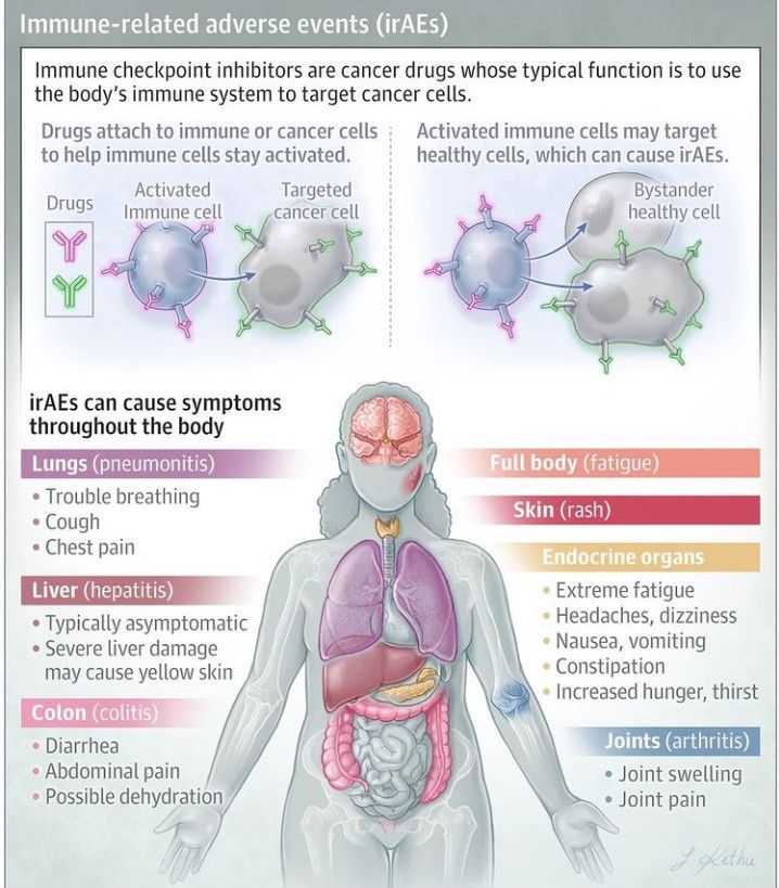 Immune related adverse events - MEDizzy